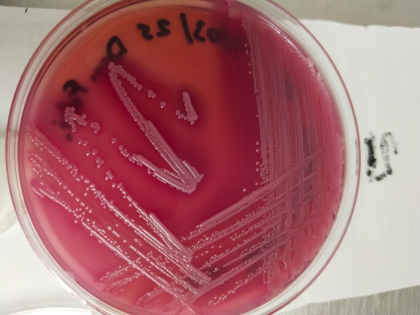 Placa de agar sangre con el estriado de siembra y colonias bacterianas aisladas.